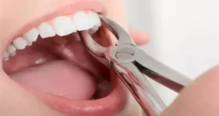 تفسير خلع الضرس في المنام: دلالاته ورموزه عند ابن سيرين