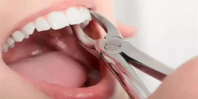 تفسير خلع الضرس في المنام: دلالاته ورموزه عند ابن سيرين