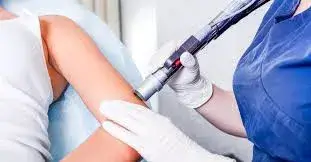 كم المدة بين جلسات الليزر: الدليل الشامل والنصائح الفعالة