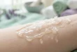 التخلص من الحبوب بعد إزالة الشعر: دليل شامل للعلاج والوقاية
